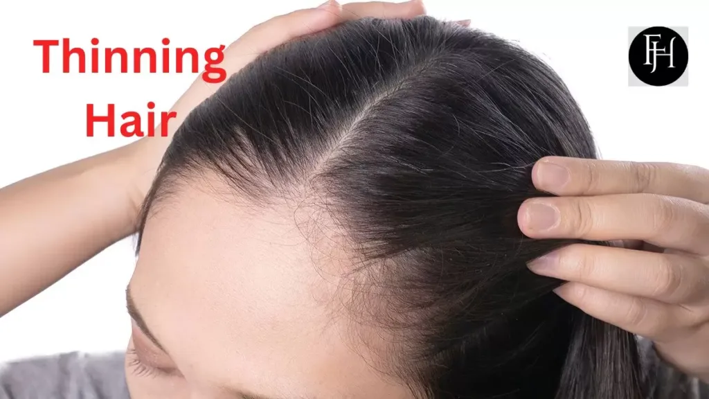 Coping Strategies for Dealing with Thinning Hair