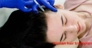 How much does a woman's hair transplant cost?