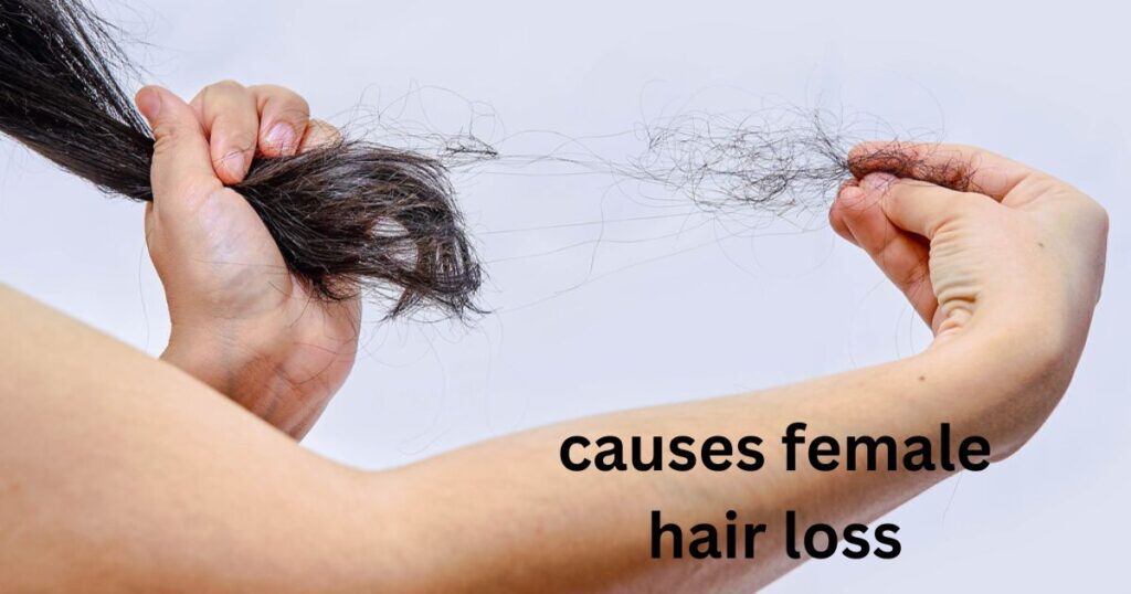 What causes female hair loss?