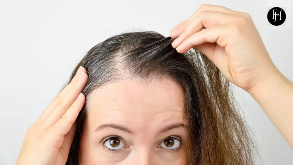 How to Fix Thinning Hair for Women?